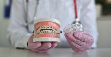 Orthodontist demonstrating dental braces with a model and clear aligner during a consultation in a modern clinic